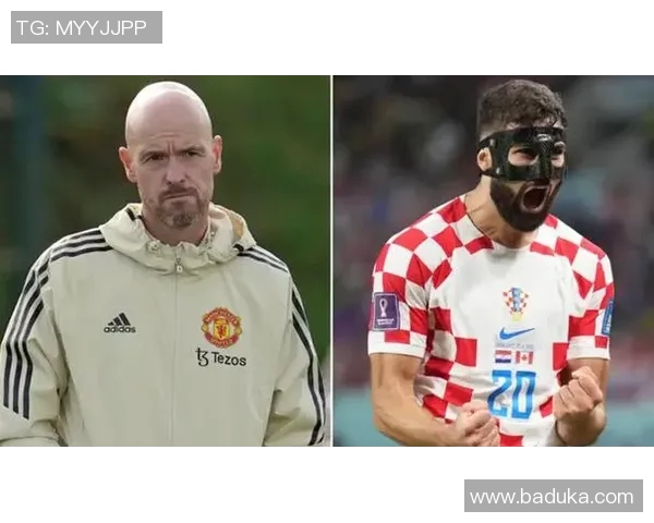 带头套的足球球星是谁 他为何选择戴上头套保护自己